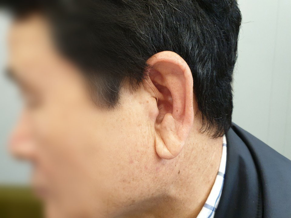 우리소리보청기 이미지