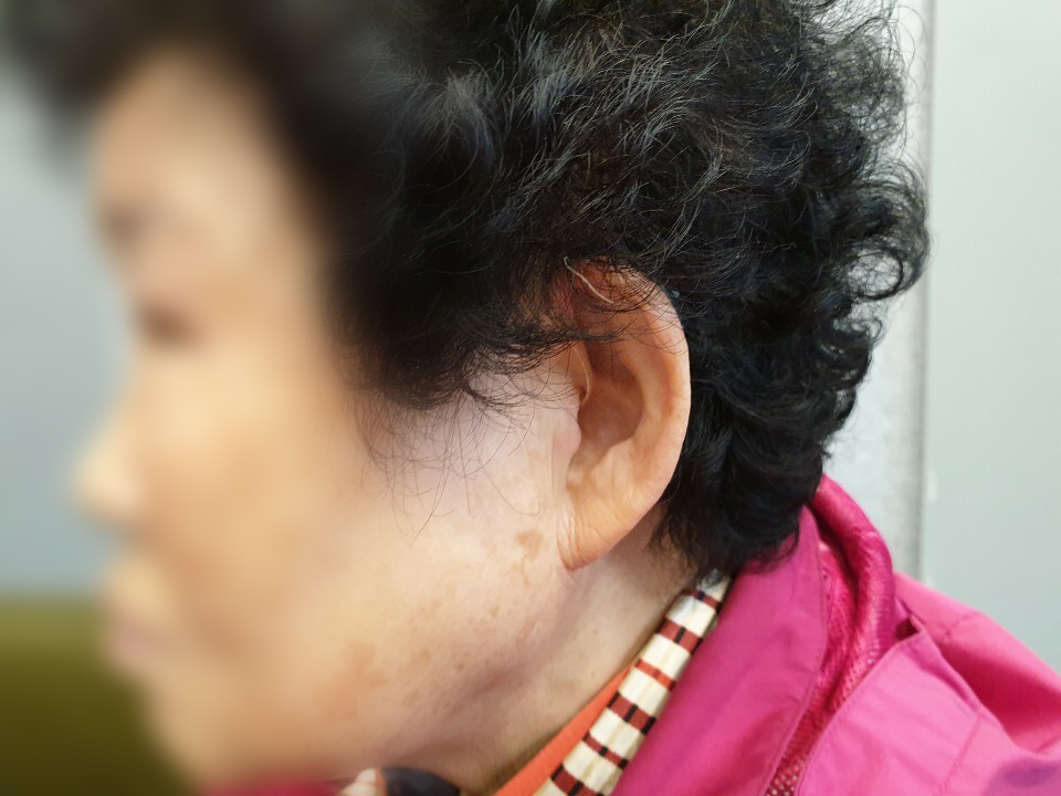 우리소리보청기 이미지