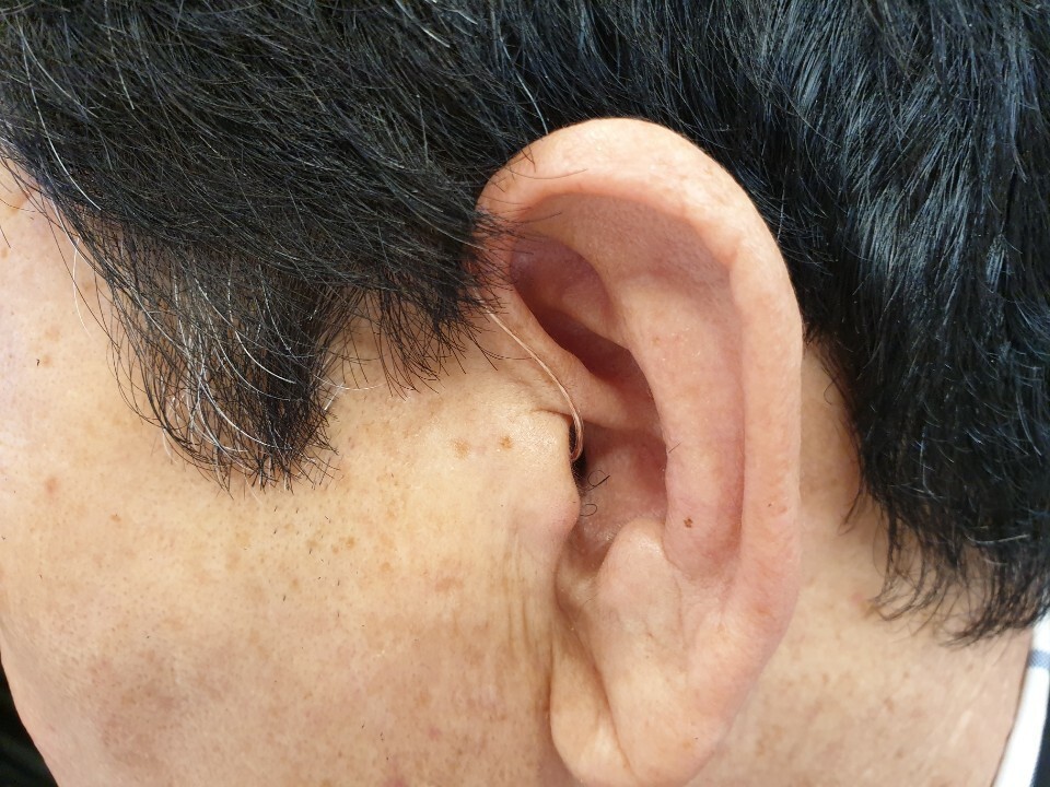 우리소리보청기 이미지