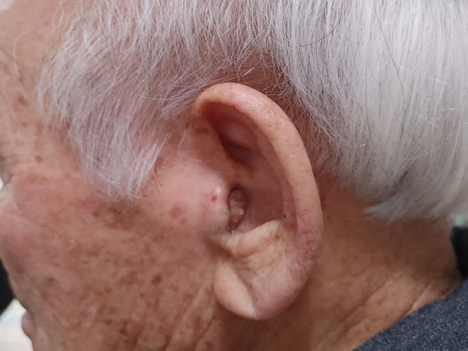 우리소리보청기 이미지